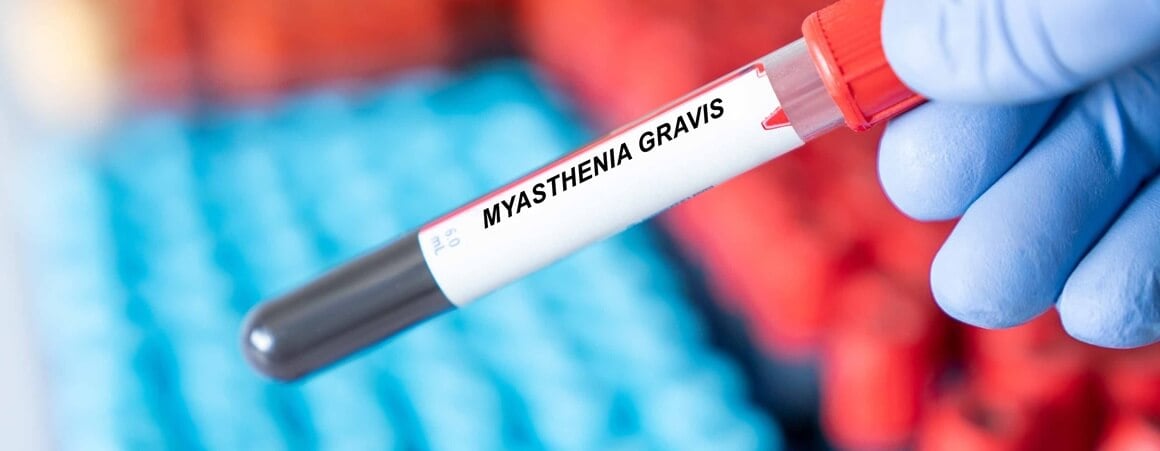 Mijastenija gravis - dijagnoza