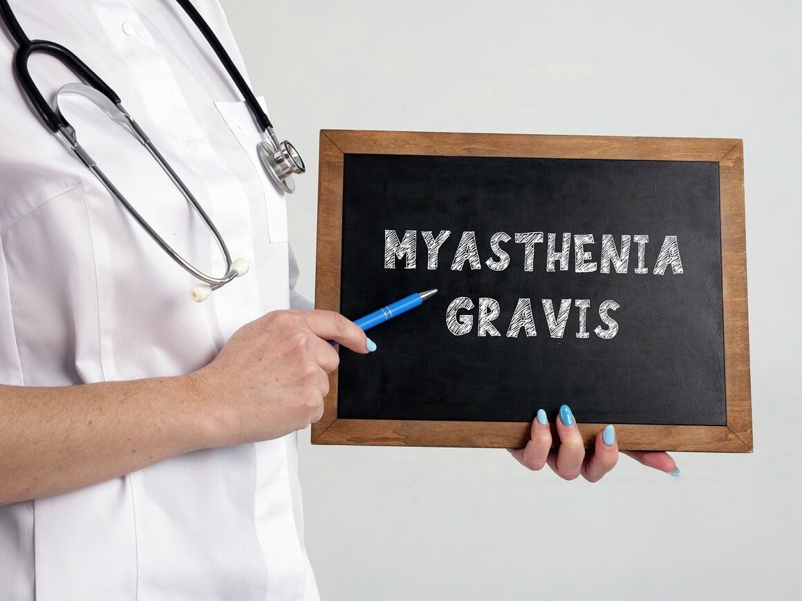 mijastenija gravis - prognoza