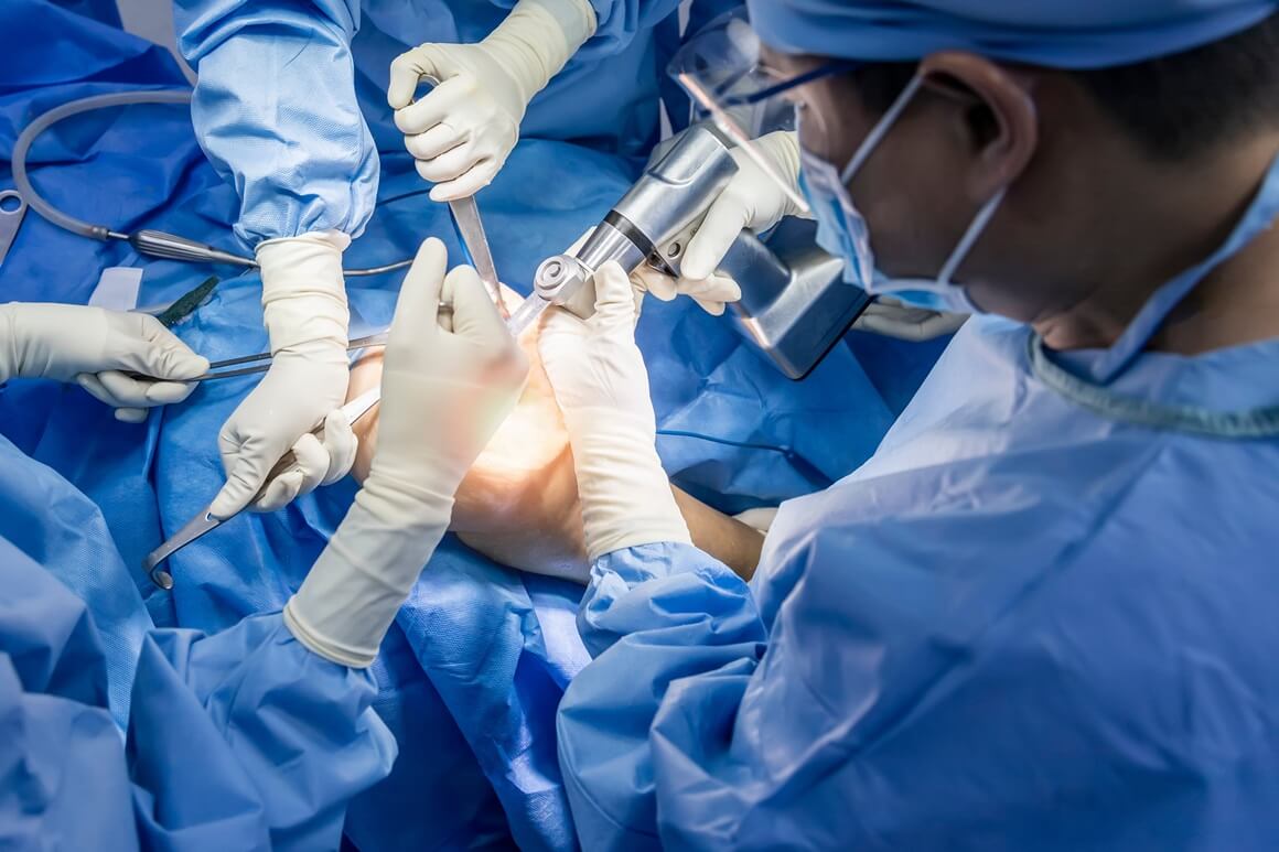 Osteoartritis - operacija