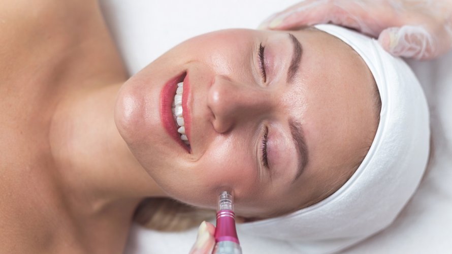 Microneedling terapija