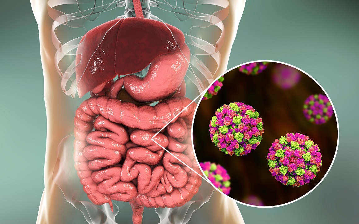 Norovirus
