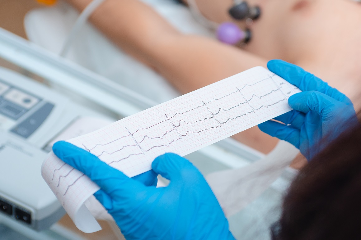 EKG ili elektrokardiogram je obavezan dio kardiološkog pregleda koji daje grafički zapis električnih potencijala srca